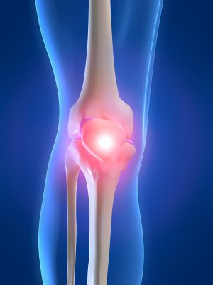 Effective Knee Pain Treatment Physiotherapy in Toronto