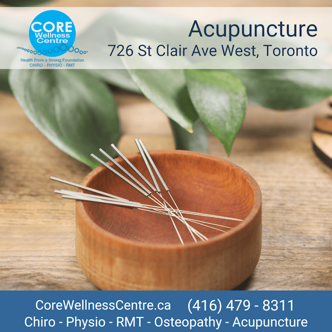 Acupuncture in Toronto