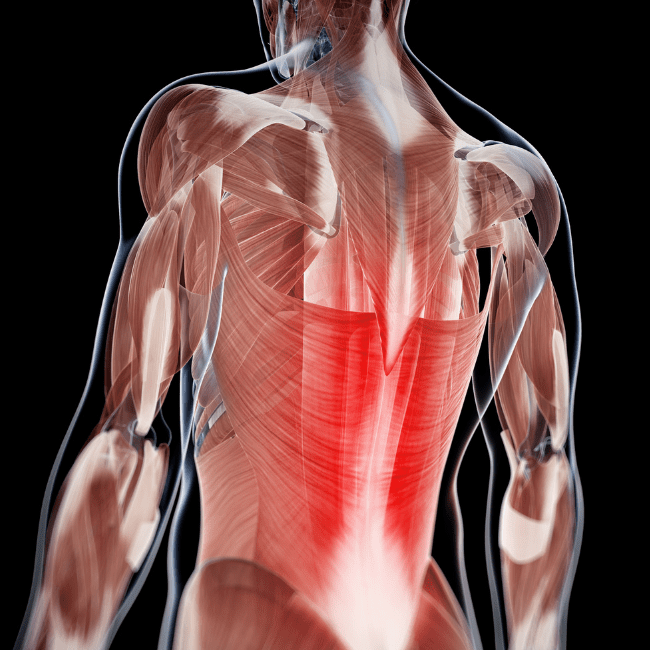 Back Muscle Recovery Toronto