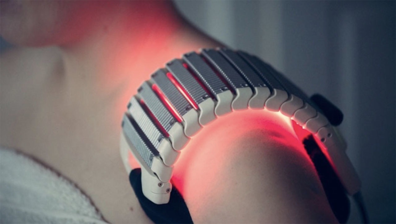 cold laser therapy