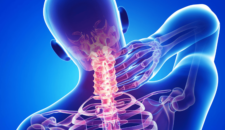 headaches neck pain source causes of headaches neck pain