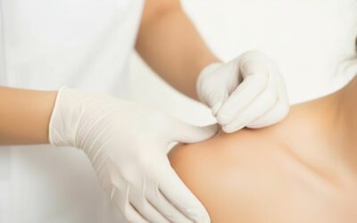 Your Guide to Dry Needling vs Acupuncture